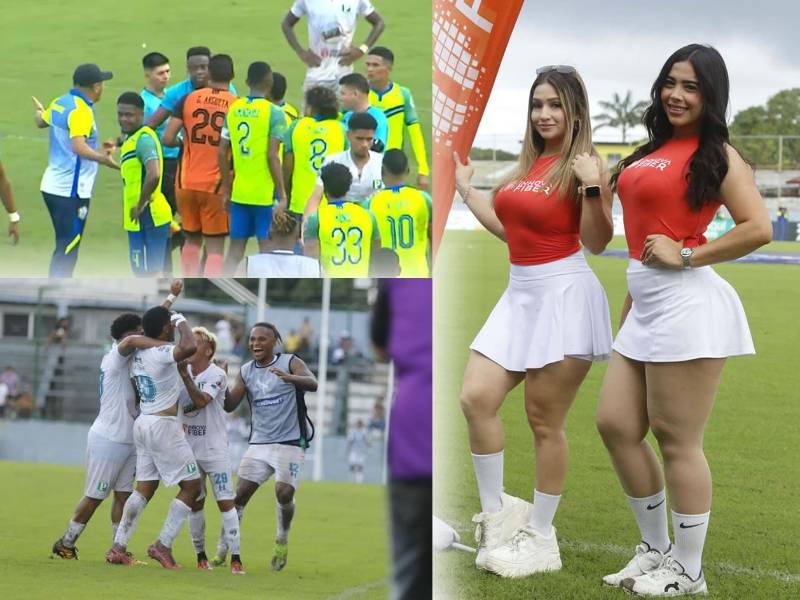 Polémico error arbitral, brutal enfado de Olancho y la fan sexy del Platense