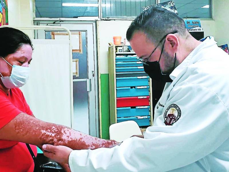 El doctor Hernán Galo revisa a una paciente con vitiligo en sus brazos; la enfermedad afecta a muchas personas en San Pedro Sula y alrededores.