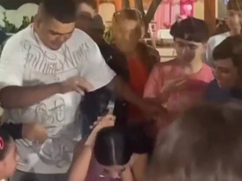 Video: Cumpleañera le saca ojo a su amigo por accidente con un cuchillo