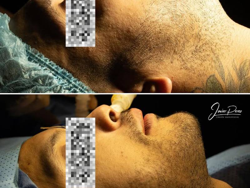 Ejemplo del antes y después de someterse a la cirugía.