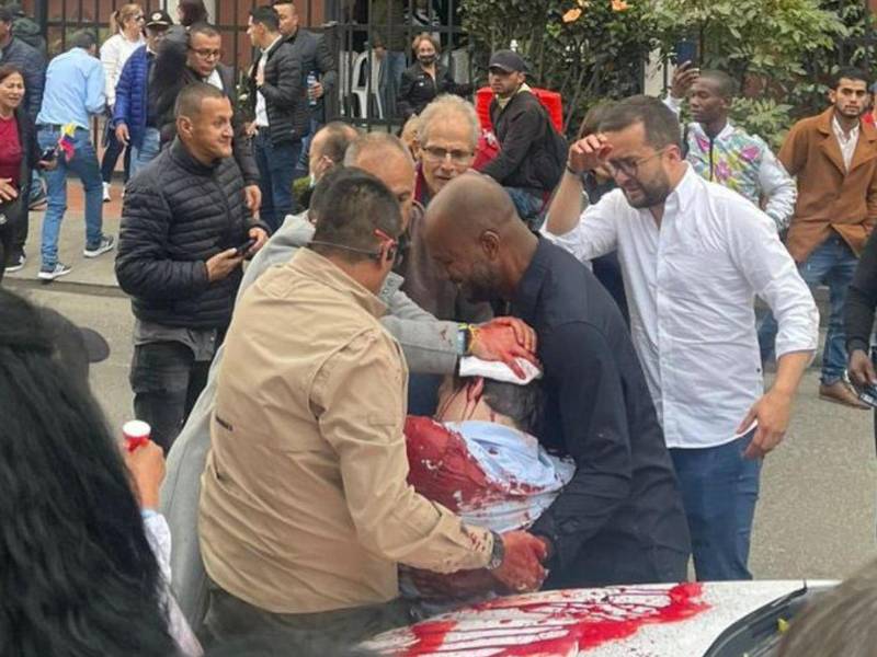 El político colombiano Miguel Uribe Turbay (c), uno de los aspirantes presidenciales del partido uribista Centro Democrático, herido durante un atentado el sábado, en Bogotá (Colombia.