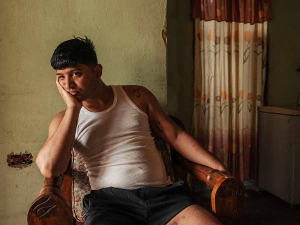 José Carmona declaró que un proyecto disparado por un guardia de la prisión salvadoreña lo alcanzó en el muslo.