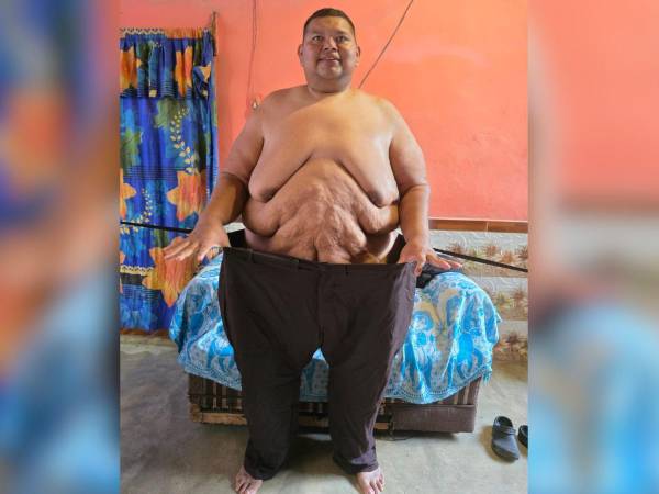 El guatemalteco Elder Castillo pasó de pesar 841 libras y permanecer postrado en una cama a convertirse en un símbolo de perseverancia para miles de personas. A continuación su historia.