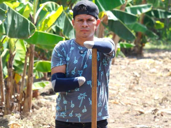 Hace siete años sus manos le fueron arrancadas con el filo de un machete. Ahora, Santos Armando Sánchez, con sus brazos mutilados, ha aprendido a usar otra vez las herramientas de trabajo, y cada día se levanta con ganas de vivir y salir adelante.