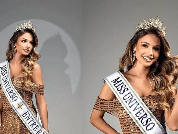 En medio de la expectativa por la final de Miss Universo 2025, que se celebrará el próximo 21 de noviembre en Tailandia, la representante argentina Aldana Masset sorprendió al revelar un aspecto íntimo de su vida: padece alopecia congénita, una condición que le impide el crecimiento de cabello en una zona lateral de su cabeza.