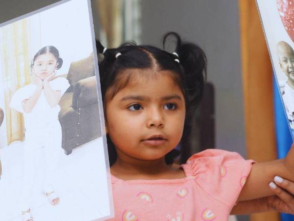 El triunfo de la pequeña Valery Michelle Martínez Lazo sobre la leucemia. Sus dos fotos, la del antes y el ahora resumen así su triunfo sobre una enfermedad de la que cada año se diagnostican 400 nuevos casos solo en la Fundación Hondureña para el Niño con Cáncer.