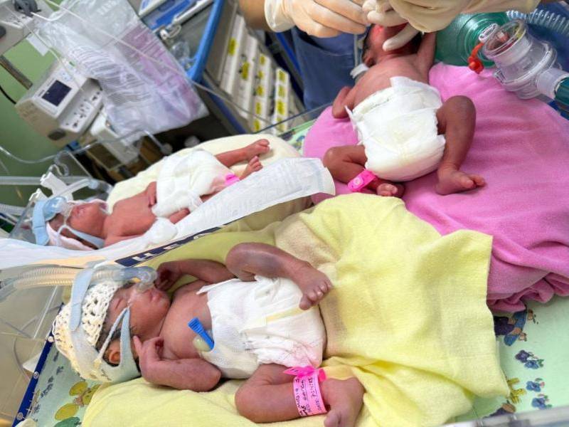Las bebés nacieron el pasado lunes 7 de abril en el hospital Mario Catarino Rivas