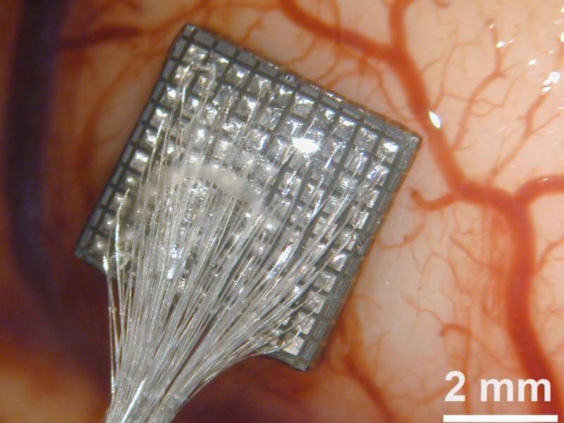 Electrodo cerebro: Imagen de una matriz de 100 microelectrodos en corteza cerebral humana.