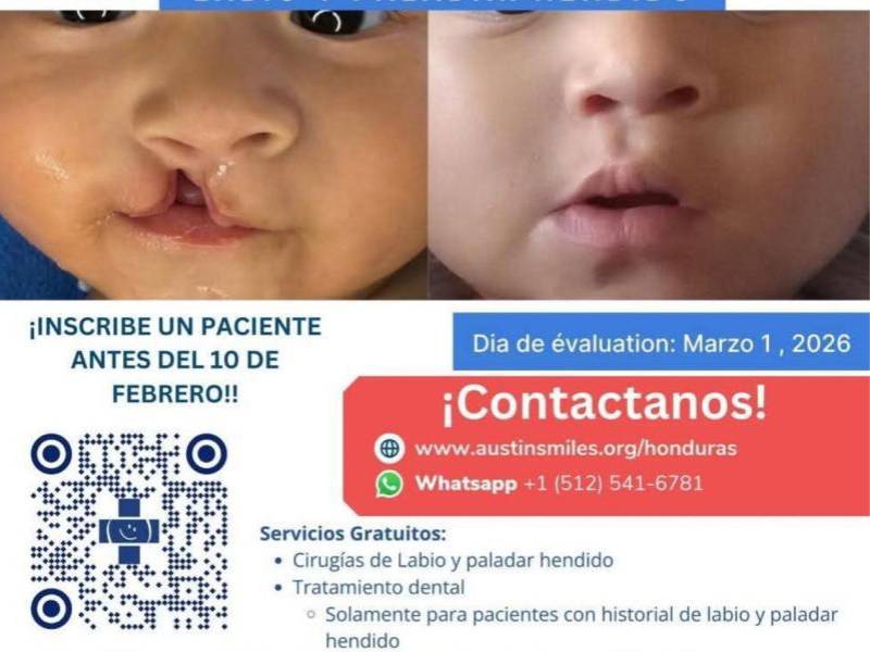 Parte del personal del hospital Leonardo Martínez enfatizó que los interesados deben abocarse a los canales oficiales para obtener información. También pueden acudir directamente al centro asistencial para realizar sus consultas.