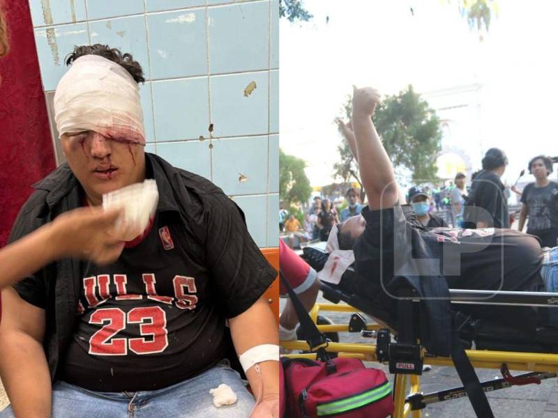 Imagénes del joven estudiante tras ser atacado durante la protesta.