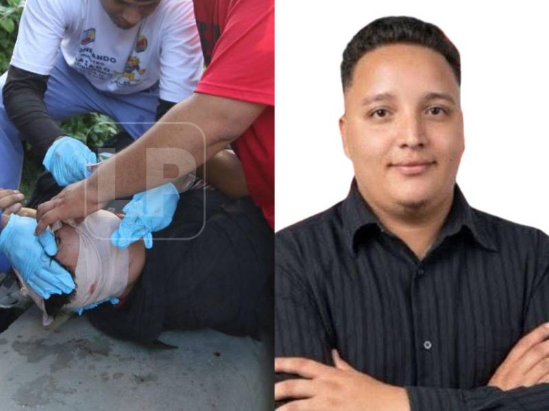 Axel Medina, estudiante de la carrera de Trabajo Social de la Universidad Nacional Autónoma de Honduras (Unah).