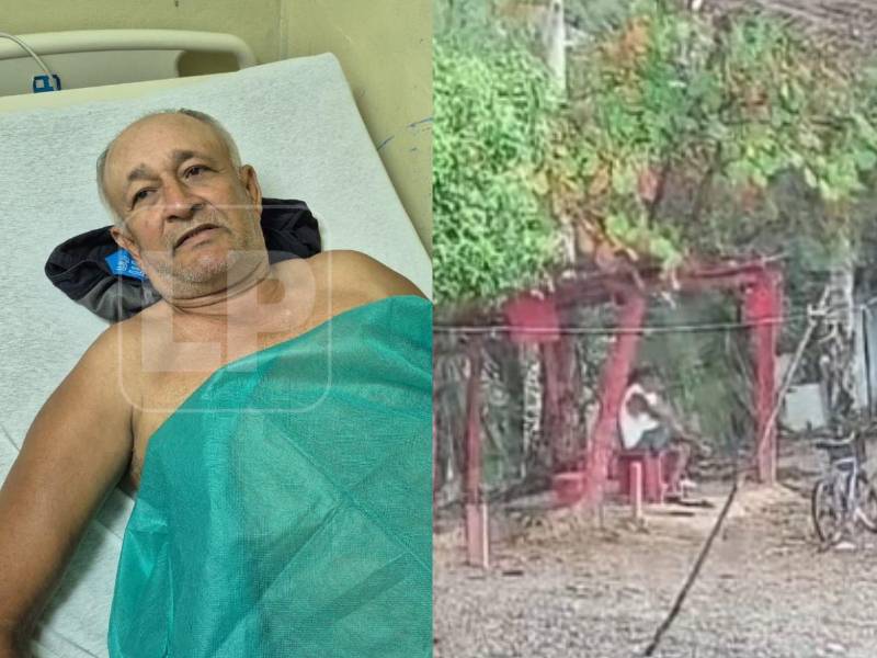 Una tarde que parecía una simple pausa para protegerse de la lluvia terminó en tragedia e incredulidad en el barrio Alvarado de La Ceiba, Atlántida, luego de que una descarga eléctrica dejara a un hombre hospitalizado y provocara la muerte instantánea de su acompañante.
