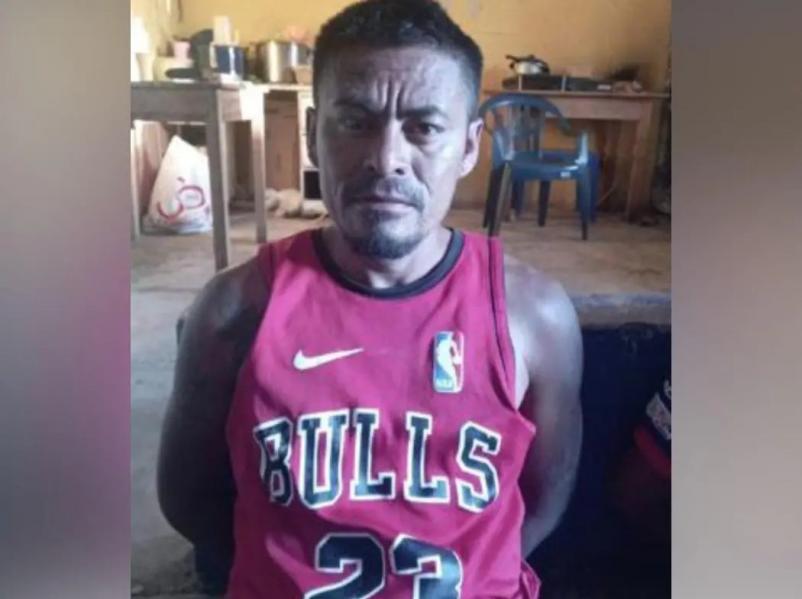 Exclusiva: Fotografía de Esteban Ferrera, alias El Diablo, herido