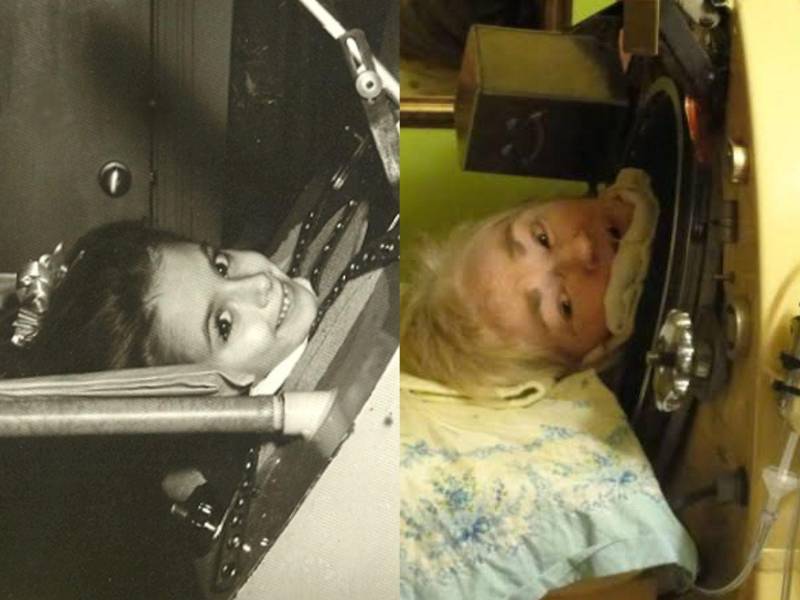 Martha Ann Lillard, considerada la última paciente conocida en Estados Unidos que sobrevivía con la ayuda de un pulmón de acero debido a las secuelas de la poliomielitis, falleció a los 78 años en Oklahoma, poniendo fin a una historia de resistencia que marcó la memoria médica de USA.
