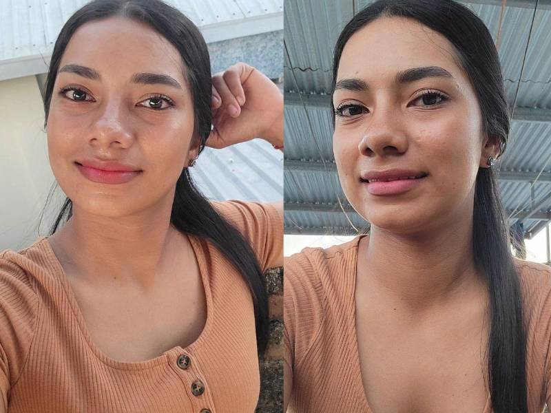 Ritzy Oviedo, de 21 años, falleció en las últimas horas en el Hospital del Sur, en Choluteca, bajo sospecha de dengue, según información proporcionada por las autoridades sanitarias.