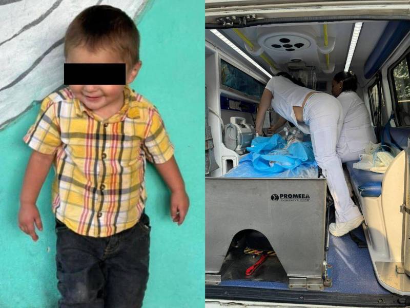 El menor fue ingresado a un centro especializado en Tegucigalpa, donde falleció por la gravedad de las quemaduras.