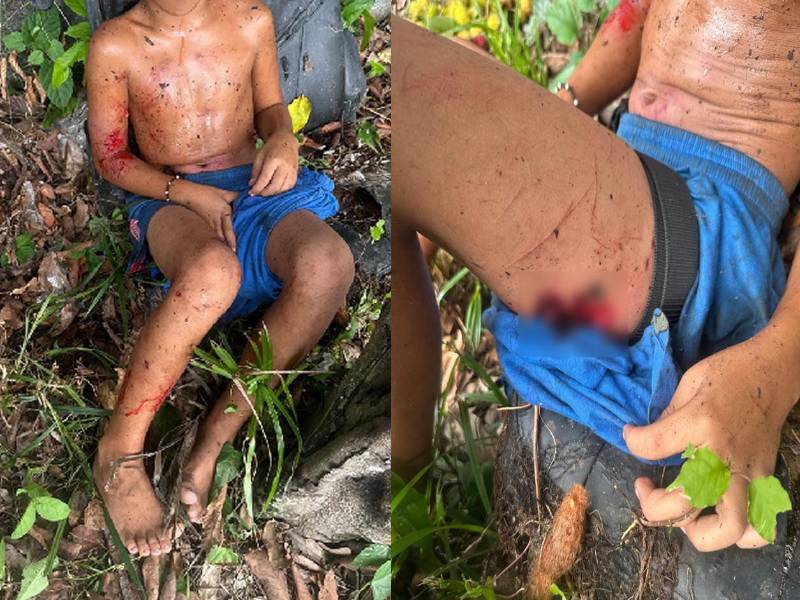 Imágenes del menor que resultó herido.