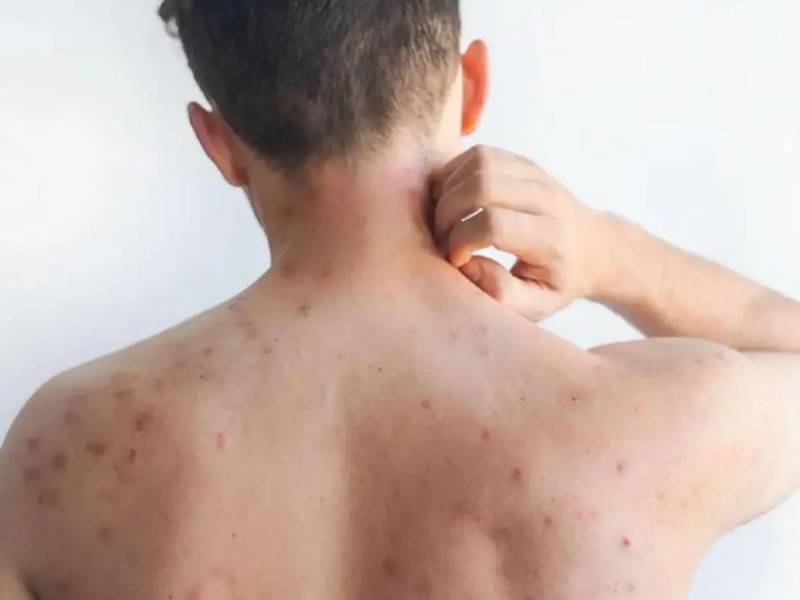 Las autoridades de Salud sostienen que la <b>vacuna</b> es segura, eficaz y el escudo fundamental para proteger las vidas.