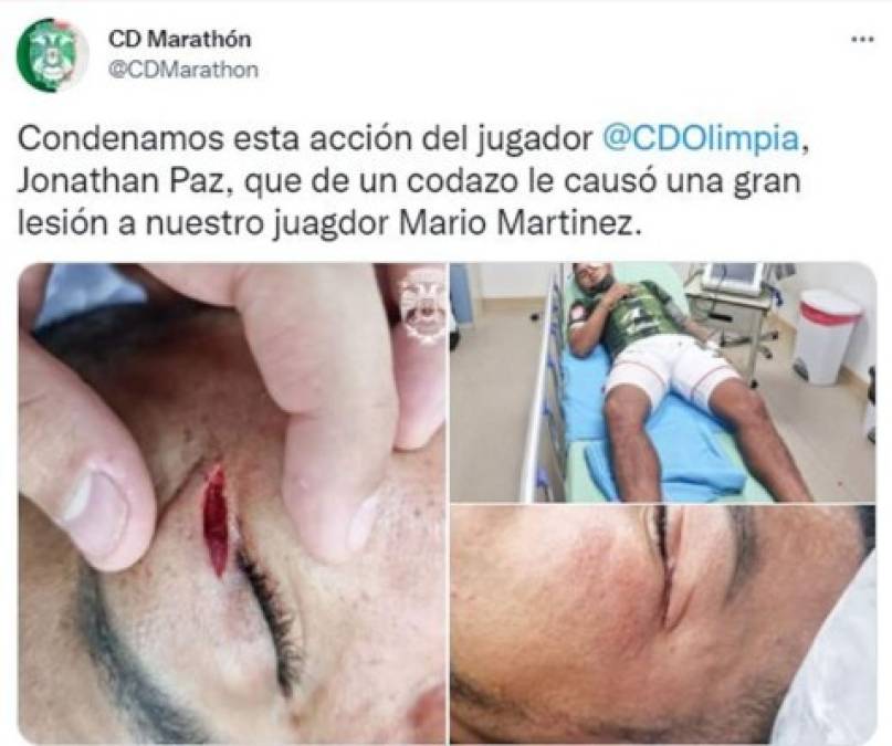 El Marathón también denunció en sus redes sociales la agresión de la que fue víctima Mario Martínez tras recibir un duro codazo en su rostro por parte del olimpista Jonathan Paz.