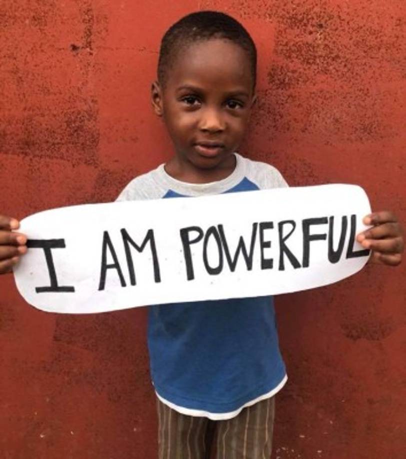 Así luce actualmente el pequeño que con su historia conmocionó al mundo.