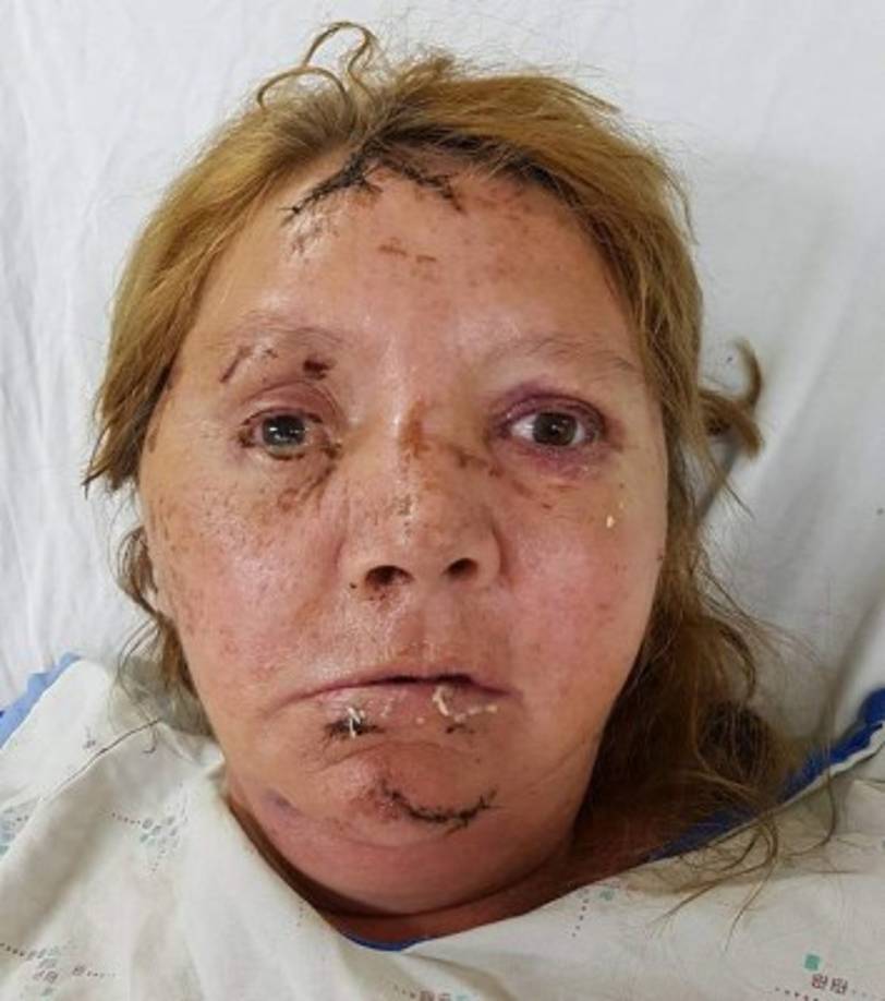 La mujer solicita ayuda a su familia para poder salir del Hospital Escuela y tener un techo donde terminar de recuperarse.