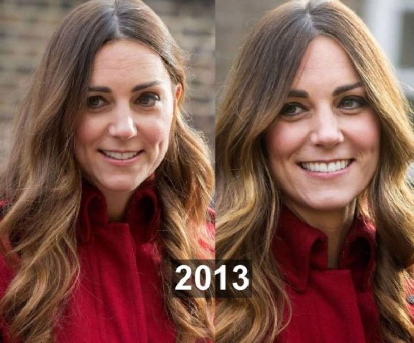 En 2013 Kate había sido atacada por mostrarse en público luciendo canas. En ese entonces la duquesa de Cambridge estaba lactando a su primer hijo el príncipe George, por lo que habría decidido prescindir de un look reluciente todo por la salud de su bebé.