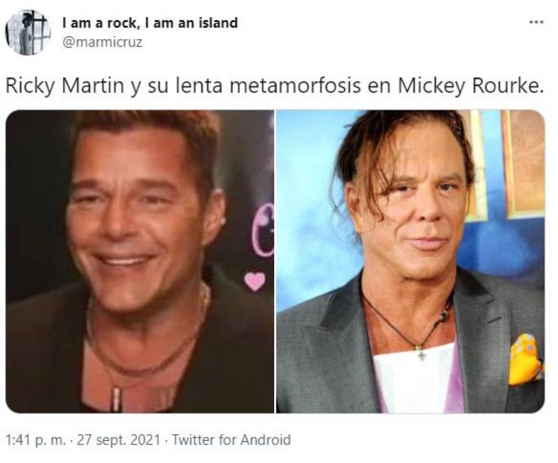 Lluvia de memes por radical cambio facial de Ricky Martin