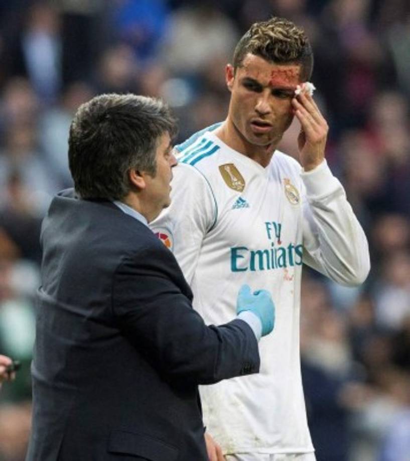 Uno de los médicos del equipo lo atendió.