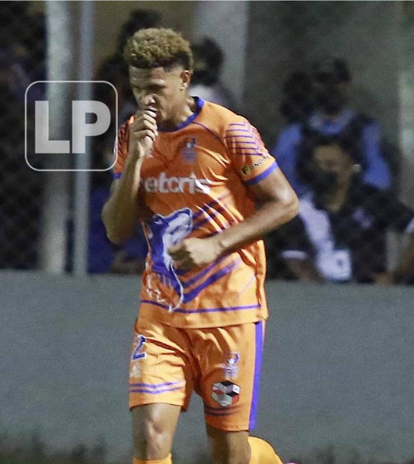 Jack Jean-Baptiste Cruz: Centrocampista que brilla en los Lobos de la UPN y por primera vez ha sido convocado a una selección Nacional de Honduras. El contención es de origen haitiano ya que su padre es de dicha nacionalidad.
