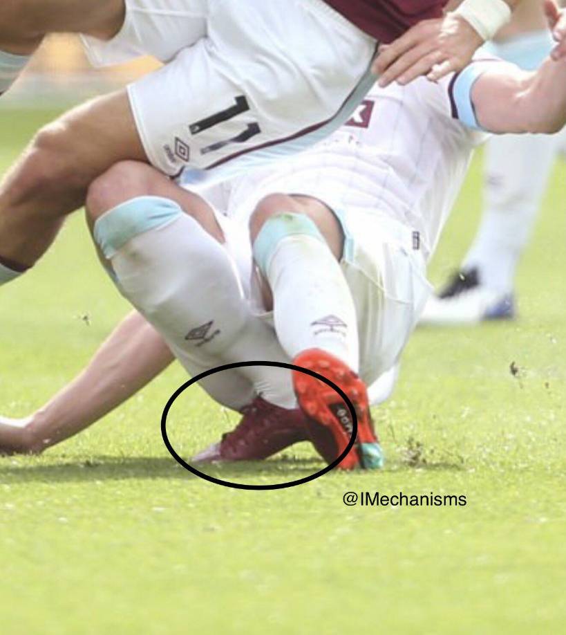 ¡No apto para sensibles! El momento exacto de la terrible lesión de Ashley Westwood.