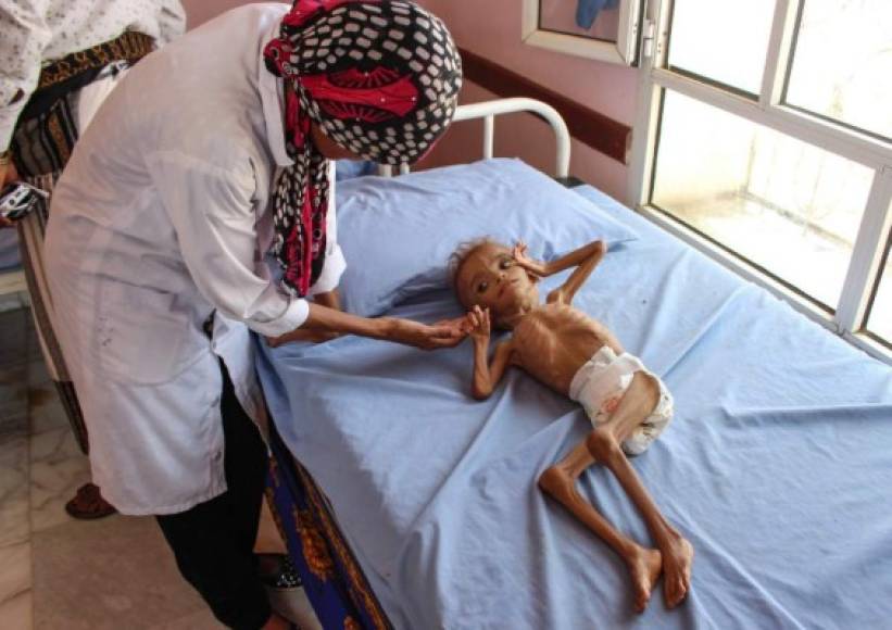'Empieza a faltar tiempo' para impedir 'una devastadora hambruna' en Yemen y 'no podemos permitir la menor perturbación' en la distribución de ayuda a las 'víctimas inocentes del conflicto', declaró el miércoles el Programa mundial de alimentos (PMA) en un comunicado.
