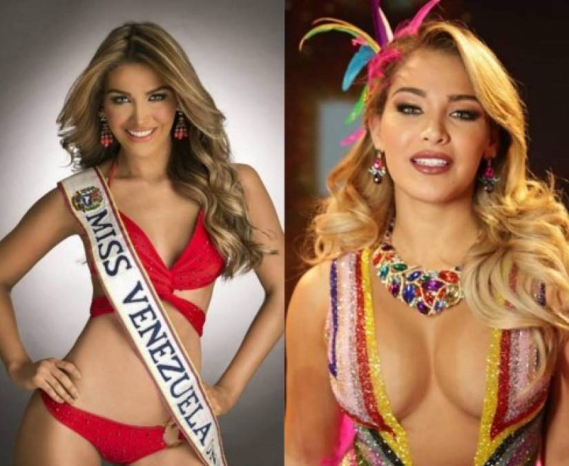 Por las fotografías desde su participación en Miss Venezuela a la actualidad parece que Migbelis se ha operada más de una vez para recalibrar su busto.