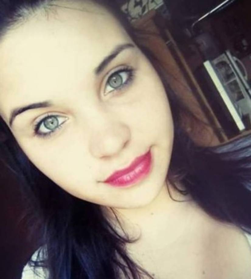 Micaela tiene el 80 por ciento de su cuerpo quemado.