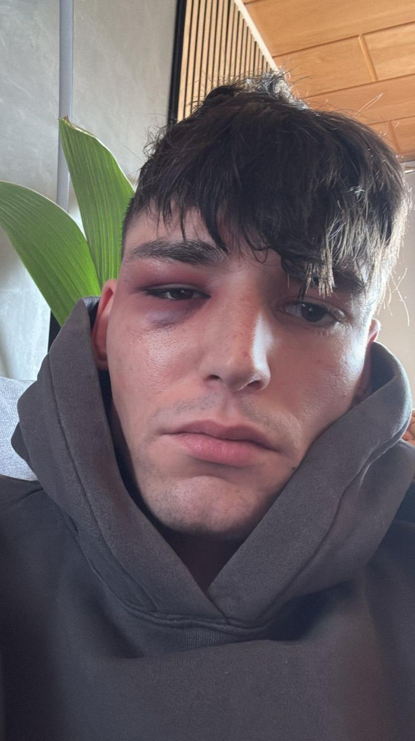 Terrible: Agreden al árbitro que pidió matrimonio a su novio en pleno partido