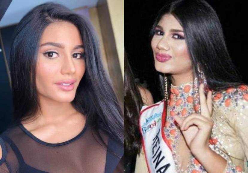 Cuando se convirtió en Miss Venezuela 2017 Sthefany reveló que participar en concurso de belleza no era fácil porque tuvo que llevar una rigurosa preparación que la mantenía muy ocupada y al mismo tiempo alejada de su novio y sus otros seres queridos, aunque no mencionó nada de cambios estéticos.<br/><br/>