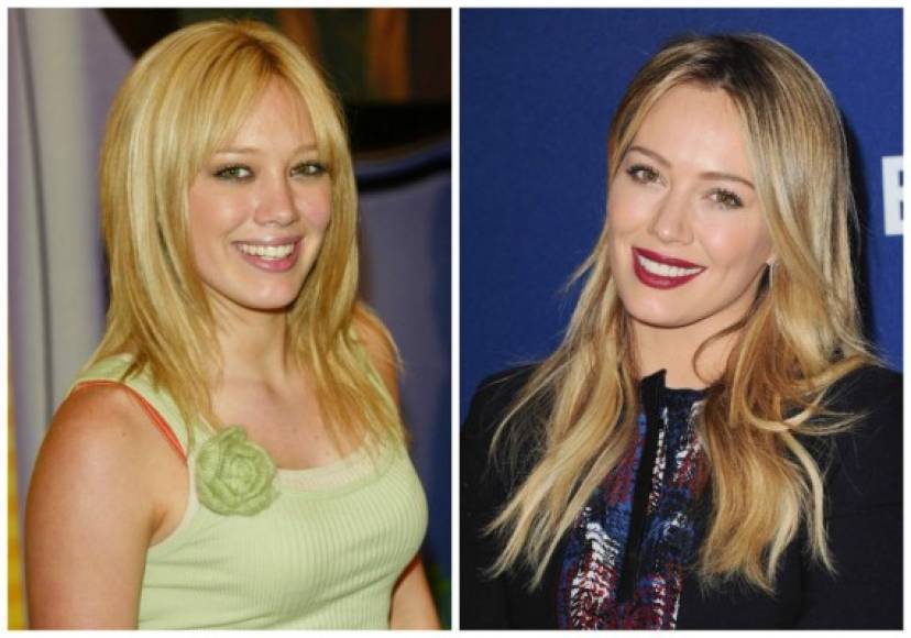 Hilary Duff también se hizo un tratamiento en su nariz.