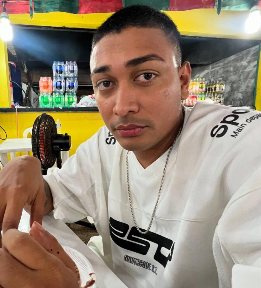 El joven confesó que algunos de sus seguidores se van a burlar, pero que igual se mostrará sin filtros.