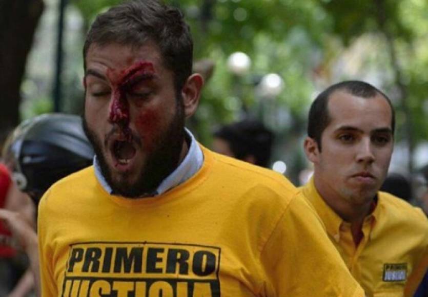 Resquenses fue agredido por un colectivo de chavistas durante una de las protestas que lideró contra Maduro en Caracas.
