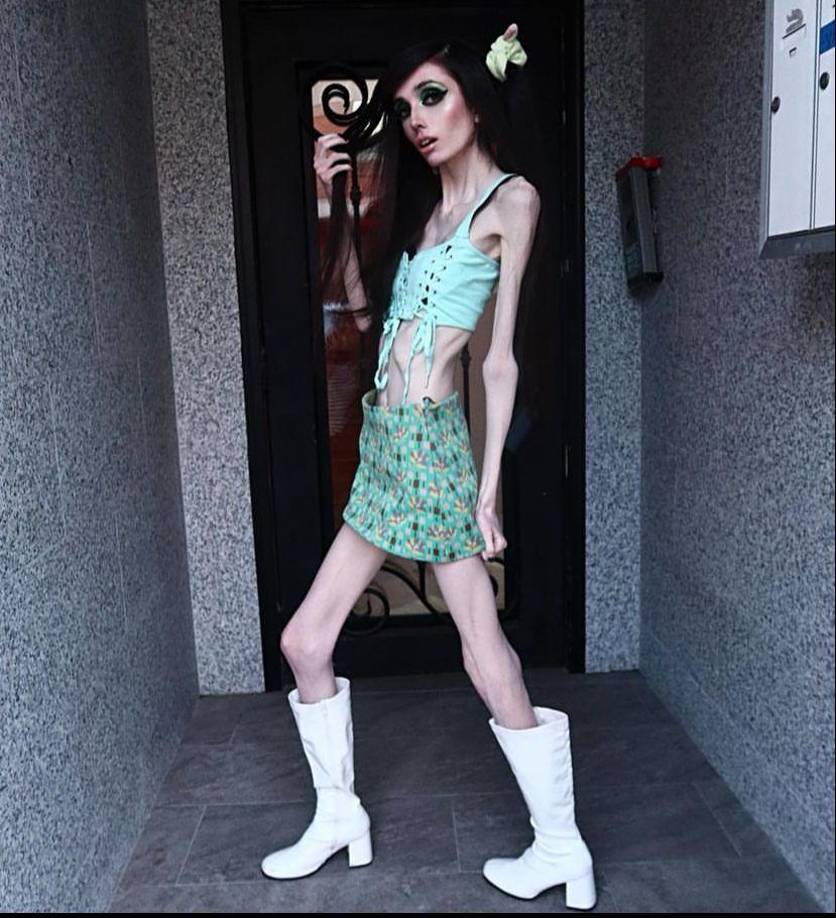 Cooney, que en ocasiones luce un aspecto gótico y de estilo emo, llegó a admitir en el pasado que padece un trastorno alimentario, algo de lo que luego se ha retractado en otras ocasiones, lo que causó también preocupación en quienes la siguen en sus redes sociales o la ven.