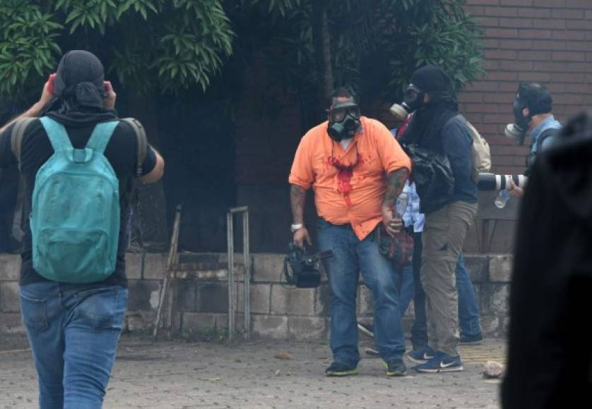 Un camarógrafo resultó hoy herido al recibir una pedrada en la cabeza durante el desalojo de una protesta de estudiantes de la Universidad Nacional Autónoma de Honduras (UNAH) que exigen la renuncia de la rectora Julieta Castellanos. AFP