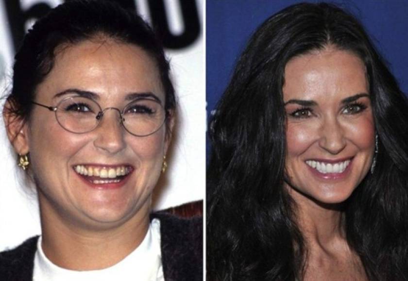 Demi Moore.<br/>Considerada una de las mujeres más guapas en el mundo del espectáculo, la actriz, modelo y productora no pudo evitar mejorar sus dientes y por ello decidió darse unos arreglitos.Tras realizar papeles pequeños, Moore consiguió la fama gracias a su actuación protagónica en 'Ghost', una de las películas más taquilleras de 1990 que le valió una nominación a los Globos de Oro.