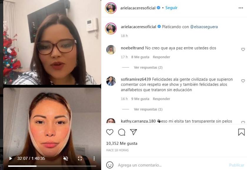 Ariela Cáceres responde a los rumores de su cirugía: “Lo que se ve no se pregunta”
