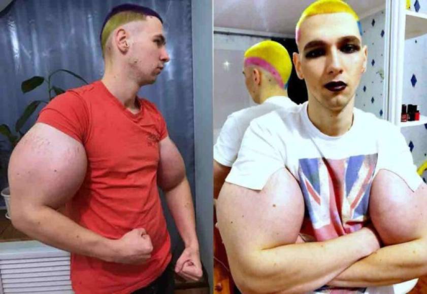 Kirill Tereshin, conocido como el 'Popeye' ruso, ha causado revuelo en las últimas horas luego de que debutó en las Artes marciales mixtas y ha vivido una pesadilla.