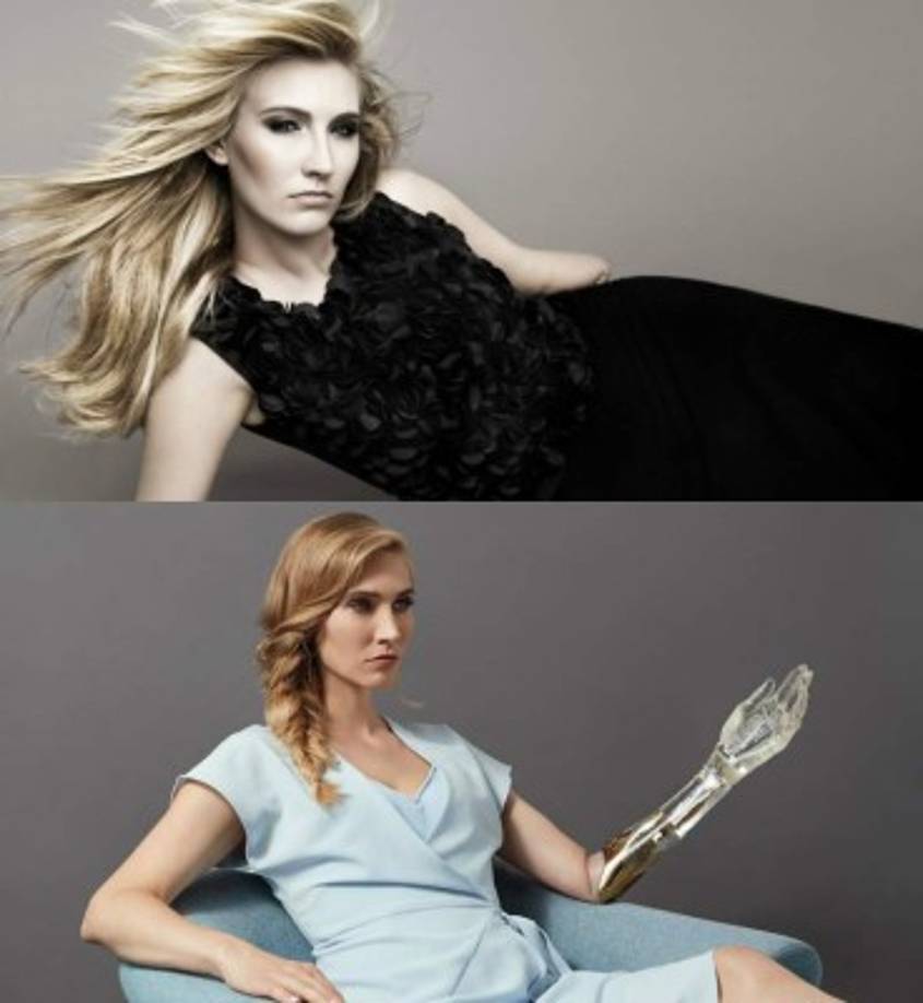 Kelly Knox: La británica es una modelo discapacitada, nació sin su antebrazo izquierdo. Pero ella decidió decir '¿y qué?' Y tomó la vida de frente. <br/><br/>Esta modelo joven y hermosa siguió su sueño y lo hizo grande como un super modelo de reputación mundial.<br/><br/>Knox se describe como una defensora dedicada y apasionada de la diversidad en la moda con el objetivo de descartar las preconcepciones de la sociedad sobre la discapacidad y cambiar el ideal de la belleza.