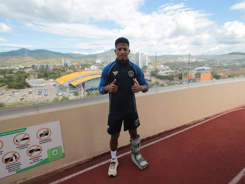 El jugador panamaño relató como ha pasado estos meses de recuperación. FOTO Estalin Irías