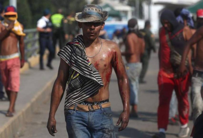 Los manifestantes heridos reciben atención médica en territorio colombiano.