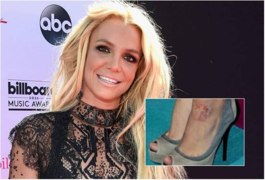 Otra estrella que ha sufrido este padecimiento es Britney Spears. <br/><br/>Ella declaró que padecía psoriasis cuando descubrió lesiones en sus tobillos en 2012. Lo que detonó la enfermedad en ella fue el estrés que vivía día con día. <br/><br/>Spears ha controlado su enfermedad con cremas y otros medicamentos. Ahora apoya a las personas con psoriasis.<br/><br/>