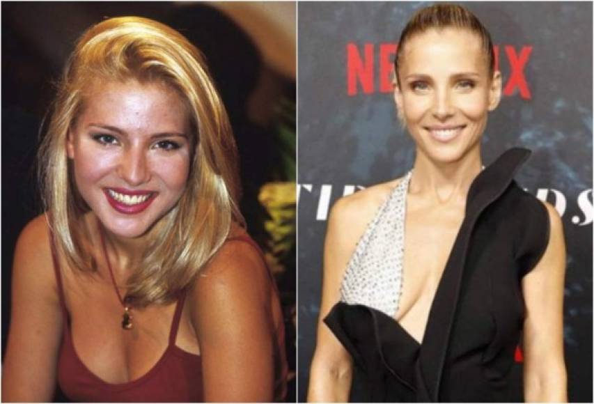 El antes y después de Elsa Pataky muestran que la española pasó por un cirujano plástico.