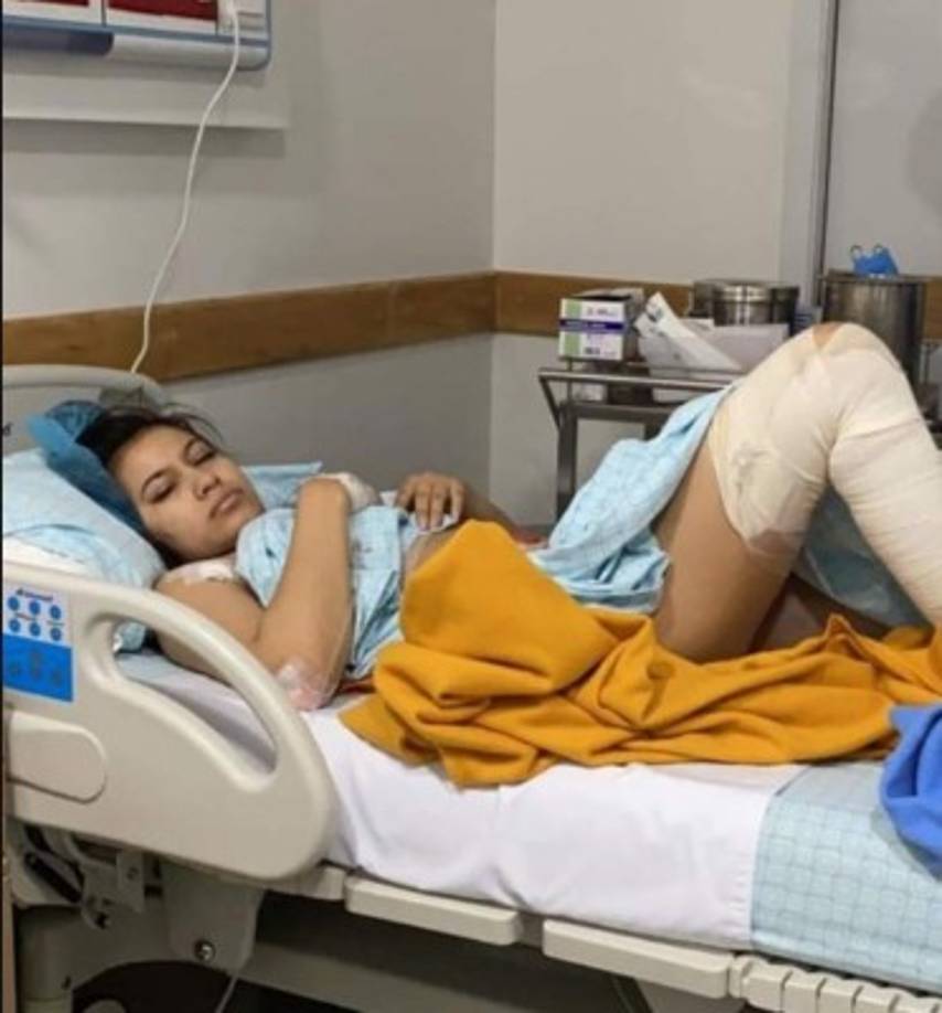 Según sus publicaciones, sus más recientes operaciones incluyen una lipoescultura para afinar su cintura, piernas y caderas.<br/>