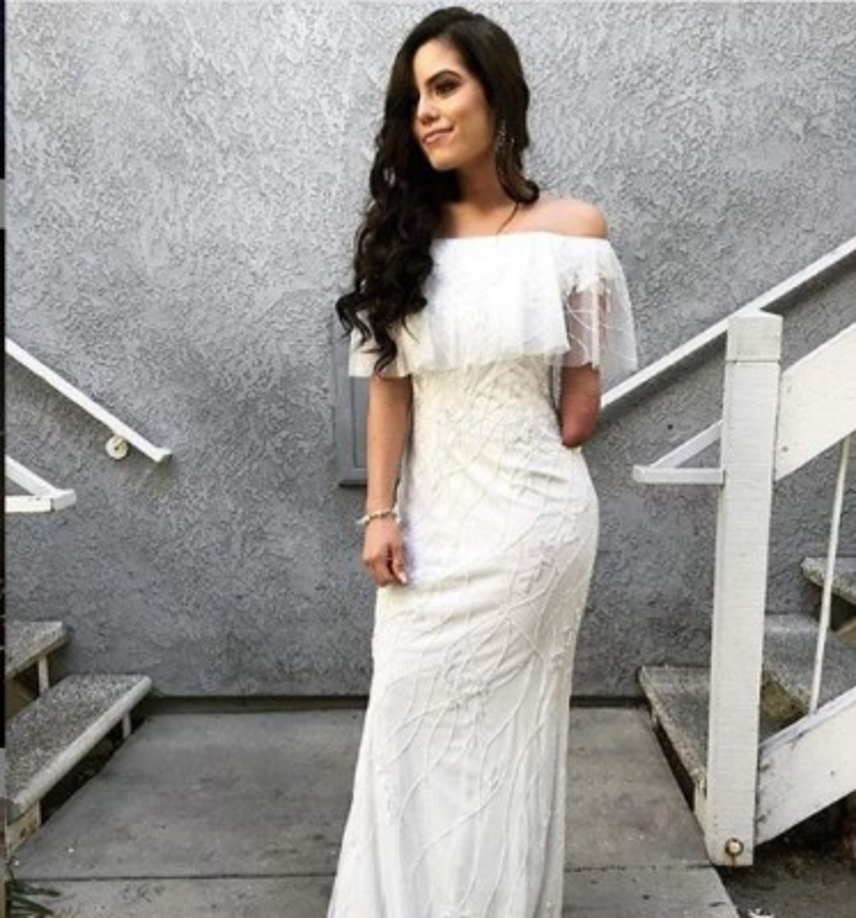 Martin asimismo contó que siendo niña sus padres le compraron un brazo protésico, pero que tiene vagos recuerdos, su madre le ha contado que rara vez se lo ponía, ya que lo utilizaba para jugar.<br/><br/>Relató que lo volvió a utilizar cuando ingresó a la secundaría, pero esto duró poco tiempo, pues tomó la decisión de que no lo necesitaba.